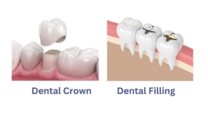 Dental crown