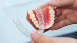 Invisalign treatment in Bristol CT